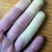Warum ändern die Finger ihre Farbe