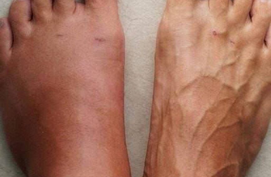 Hier sind die 6 Symptome