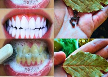 Wie kann man Zähne mit Nelken und Lorbeerblättern aufhellen