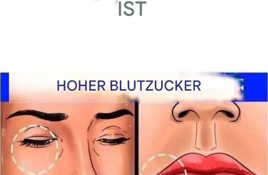 12 Anzeichen dafür, dass Ihr Zuckerhaushalt im Körper aus dem Gleichgewicht ist