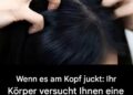 Juckt Ihre Kopfhaut? Hier sind die Hauptursachen.