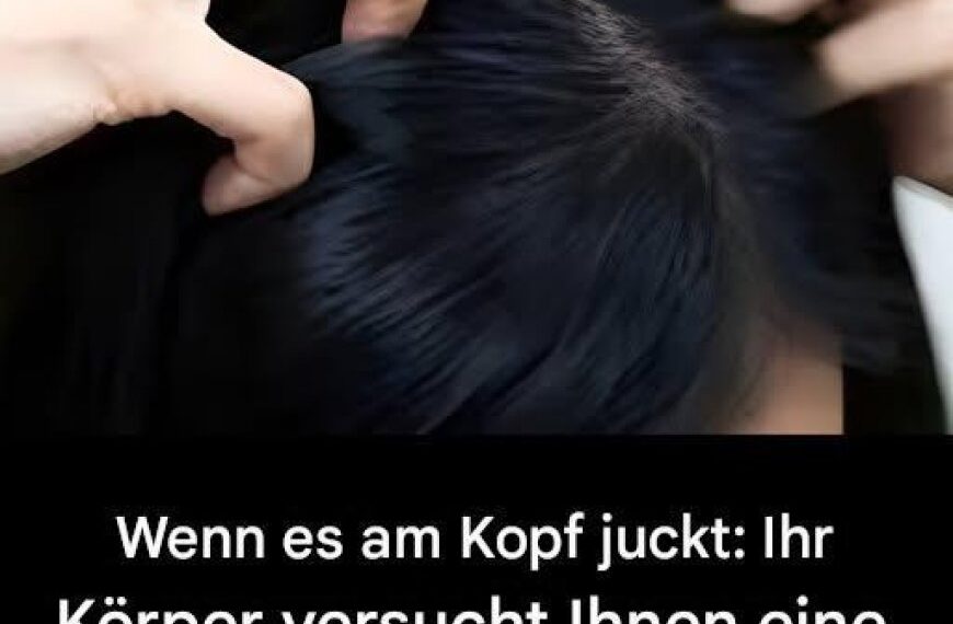 Juckt Ihre Kopfhaut? Hier sind die Hauptursachen.