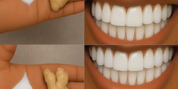 Zähne auf natürliche Weise in nur wenigen Minuten mit Ingwer und Salz aufhellen: Ein wirksames Hausmittel